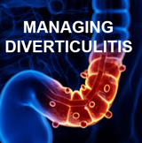 Managing Diverticulitis